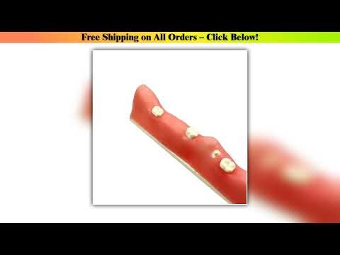 Dental Impacted Tooth Model Unerupted Tooth Extraction Practice Training Model Resin Wisdom Teeth