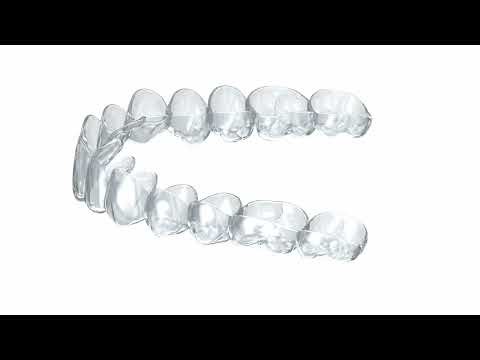 Invisalign treatment process animation in North Hollywood