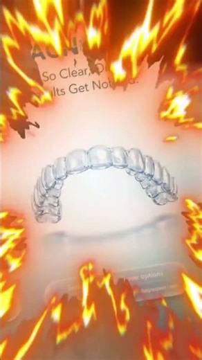 Clear Aligners Explained | Invisible Teeth Straightening by Dental Experts