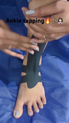 # physiotherapy # # Tapping For ankle # 🔥👩‍⚕️⚕️🩺🔥