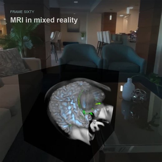 3D MRI Visualization in Real Space with DICOM Data | Sean McCue posted on the topic | LinkedIn