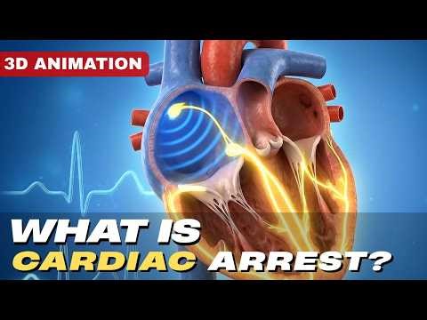 What is Cardiac Arrest? Explained in 3D Animation