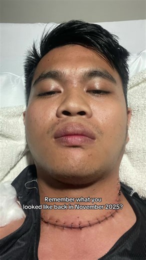 Thyroid Cancer Journey: It Gets Better