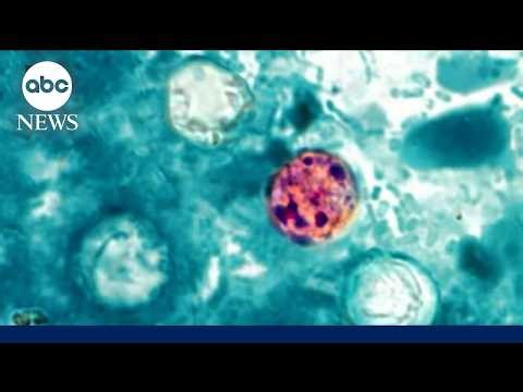 Health alert about cyclosporiasis parasitic infection