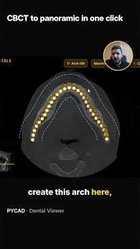 CBCT to panoramic in one click #dentalradiology #medicalimaging #dicom