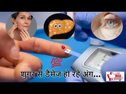 डायबिटीज होना शरीर के लिए क्यों खतरनाक है? | Sugar Jada Badhne se Organ Damage kyu hote hai?