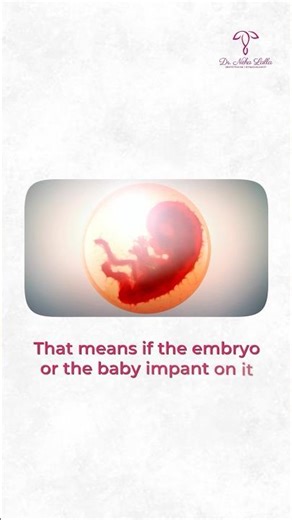 Why Some Miscarriages Keep Repeating