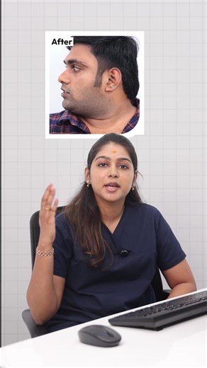 ✨ Get Clear, Spotless Skin with the Carbon Laser Peel! ✨ Step into VCare Clinics and Explore Now! Why It’s a Skin Game-Changer: ✅ Fights acne, pigmentation & enlarged pores ✅ Smoothens skin texture & restores your natural glow ✅ Visible results from the very first session 🎉 Special Launch Offer – Flat 30% OFF! 📍 Walk into your nearest VCare Clinic 📞 Call us at 91 95000 02401 📲 Tap “Get Offer” and reveal skin that truly shines! | VCare