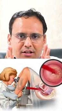 Cervical Cancer Treatment Explained | Surgery, Radiation & Chemotherapy