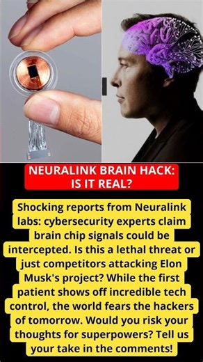 NEURALINK BRAIN HACK: IS IT REAL?
