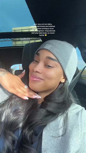 Achieve Glass Skin with Kirah Ominique Acne Regimen