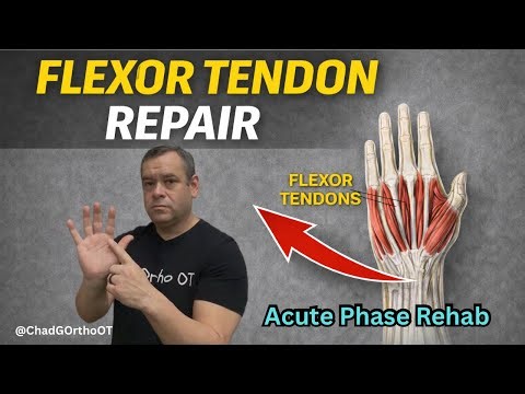 Flexor Tendon Repair Rehab (Acute Phase)