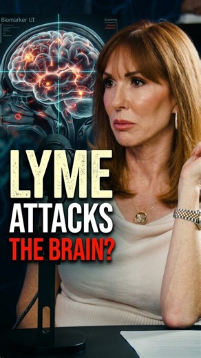 The Scary Truth About Lyme Disease and the Brain #Lyme #BrainHealth #MentalHealth