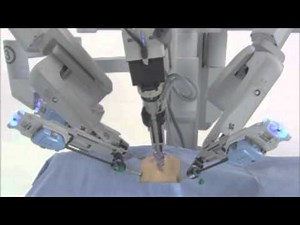 da Vinci Surgical System