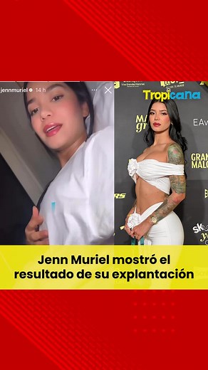 Hace un tiempo Jenn Muriel confesó que no se sentía cómoda con sus prótesis mamarias, por lo que se realizaría una explantación. A través de sus redes sociales, la creadora de contenido mostró el resultado.😱😱🤔🤔 #Tropicana #Bogotá #Tendencias #Famosos #JennMuriel #Explantacion #Fyp