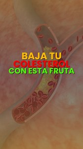 🍅🌱 ¡Descubre el poder del tomate de árbol para reducir el colesterol! 🙌🏼✨ En este video te cuento todo sobre sus beneficios, cómo consumirlo y qué contiene. ¡No te lo pierdas! 🎥💚 #tomatedeárbol #SaludTotal #colesterolbajo #vidasana #Bienestar | Ramon Heredia