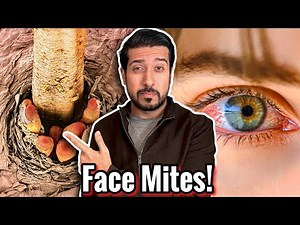 Blepharitis and Eye Mites: The 5-Step Easy Fix for Red Itchy Eyelids