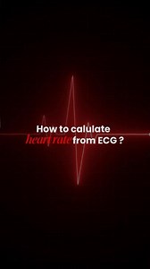 How to calculate Heart rate from ECG