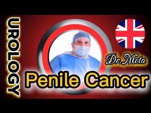 Penile cancer. Do you have a lesion on your penis that won't heal and gets worse? Watch this video.