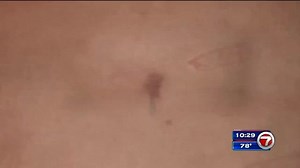 Where Is My Belly Button? - WSVN 7News | Miami News, Weather, Sports | Fort Lauderdale