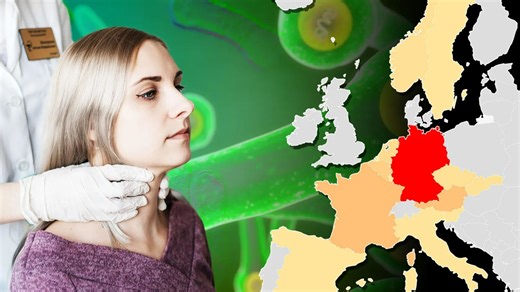 Warning as highly contagious 'bull-neck' infection spreads rapidly across Europe