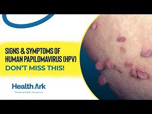 Early Signs of HPV in Men & Women | Full Breakdown #hpv #hpvsymptoms #hpvvaccine #hpvawareness