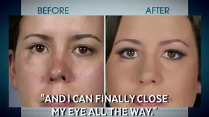 "Botched" Recap (S5 Ep16): A Revision Runs Through It