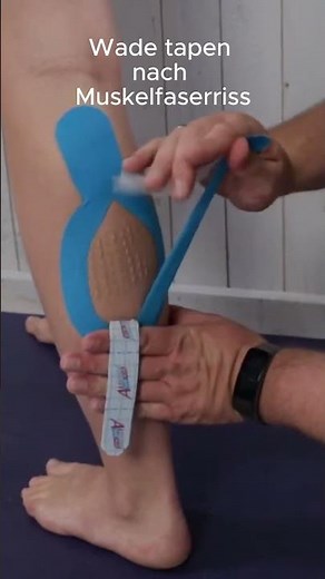 Calf taping after muscle fiber tear
