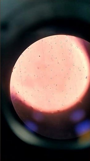 bacillus typical spores under Microscope #bacteria #bacillus #spores #microbes #classy