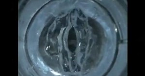 Synthetic gel could restore function to damaged vocal chords