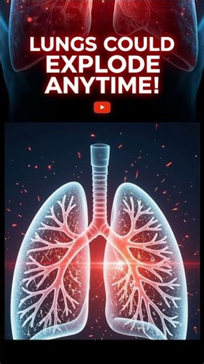 Your Lungs Can Explode Without Warning! 💨💀