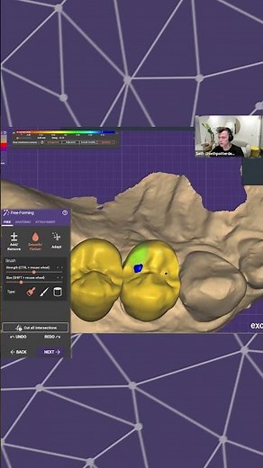 exocad Training Session - Seth Potter