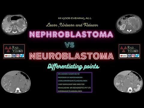 NEPHROBLASTOMA VS NEUROBLASTOMA