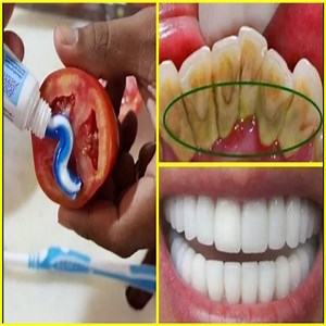 14K views · 720 reactions | Teeth Whitening Remedy - Get Whiten Teeth​ in just 2 minutes with Tomato and Toothpaste.#TeethWhitening #Whiteteeth | Health Zone | Facebook