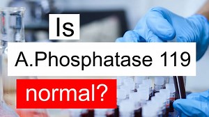 Is Alkaline phosphatase 119 normal, high or low? What does ALP level 119 mean?