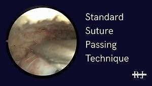 Bio-Fertilization Protocol for Rotator Cuff Repair