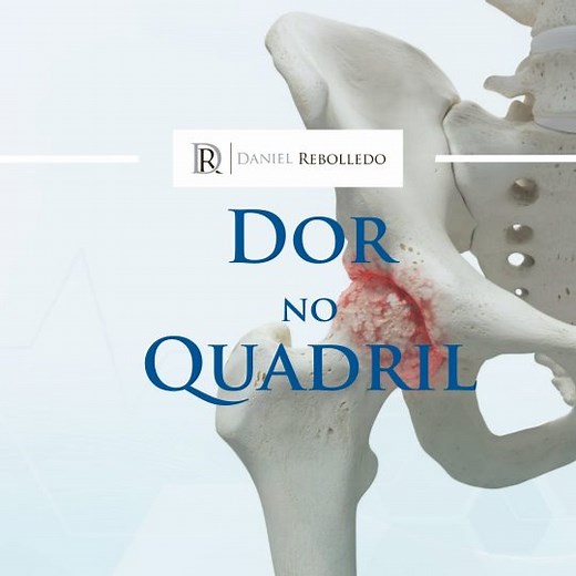 Dor no Quadril. O que pode ser? | Blog | Dr. Daniel Rebolledo