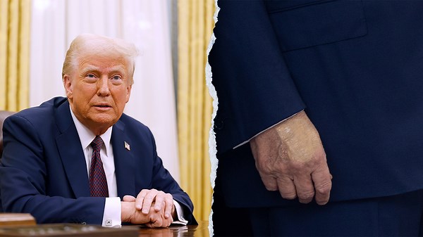 White House releases Trump health update after speculation over swollen legs, bruised hands