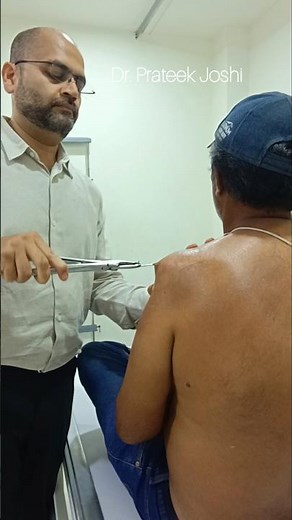 K wire removal procedure #ortho #kwire #accident #fracture