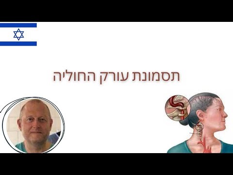 תסמונת עורק השדרה. תסמינים, אבחון, שיטות טיפול
