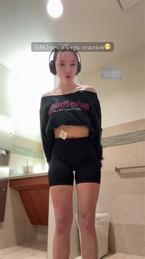 Silly mast cells #chronicillness #health