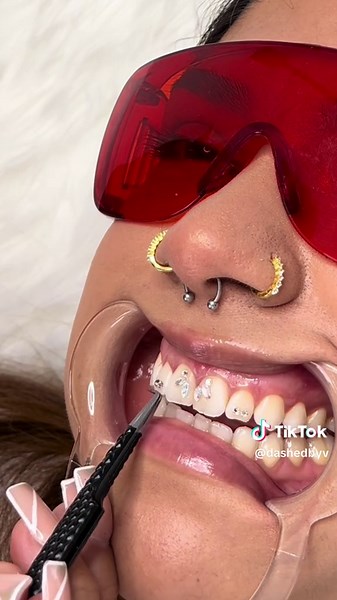 Best Tooth Gem Designs and Training in the Bay Area