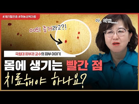 몸에 생긴 🔴빨간 점🔴이 혈관종이라고요?!😨｜체리혈관종? 화농성 육아종?🤔치료해야 하는 건가요? - [언니네피부과]