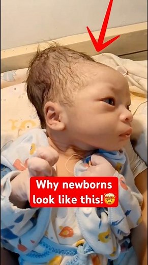 Weird Things That Happen Right After Birth!