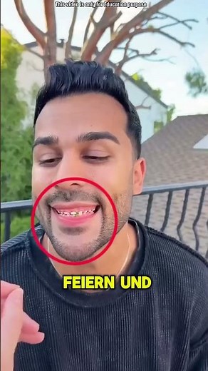 Die Zähne des Jungen waren wie die einer Maus und die Zähne des Mädchens wie die eines Elefanten 😲