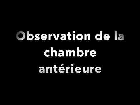 Optician Training Observation of the eye under a biomicroscope - Biomicroscopy - EasyOpto