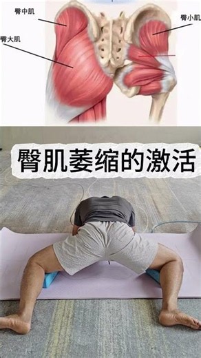Fix Gluteal Atrophy: Best臀肌萎缩修复方法
