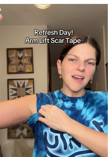 Best Practices for Changing Scar Tape After Surgery