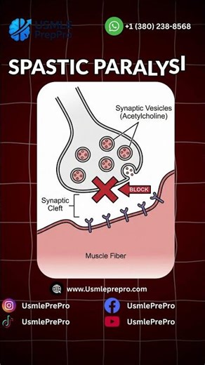 Botulism vs Tetanus: Key USMLE Differences & Mechanisms