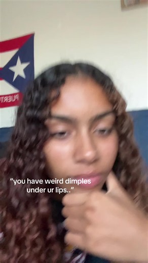 Dimples Below the Lower Lip: Why Some Look Off-Center